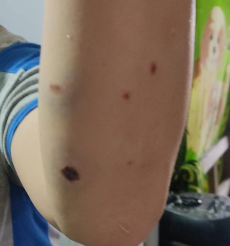 Así fue como dos perros pitbull atacaron a su dueña en Maldonado (imágenes sensibles)