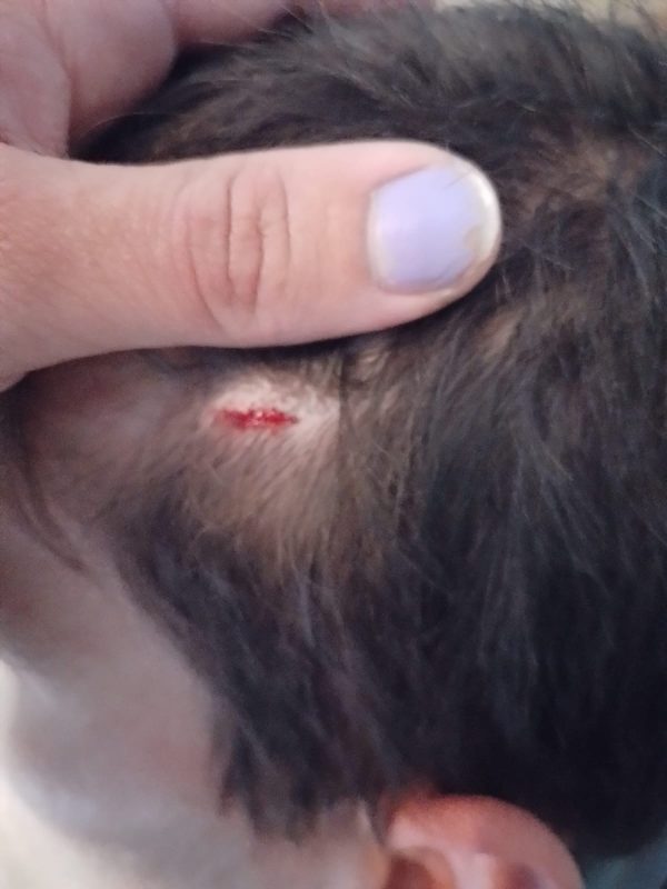 Otro hecho de violencia donde un trabajador denunció que fue atacado por el encargado de un edificio