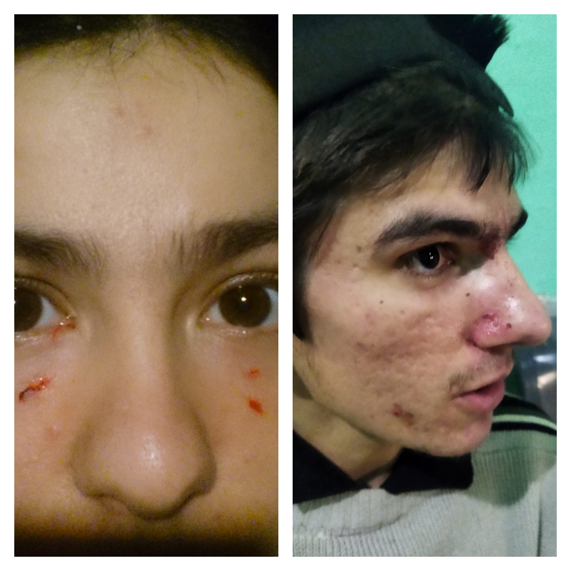 Jóvenes de San Carlos denuncian haber sido torturados por policías